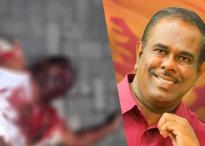 Specialist Forensic Medical Officer Testifies in MP Amarakeerthi Athukorala Murder Trial